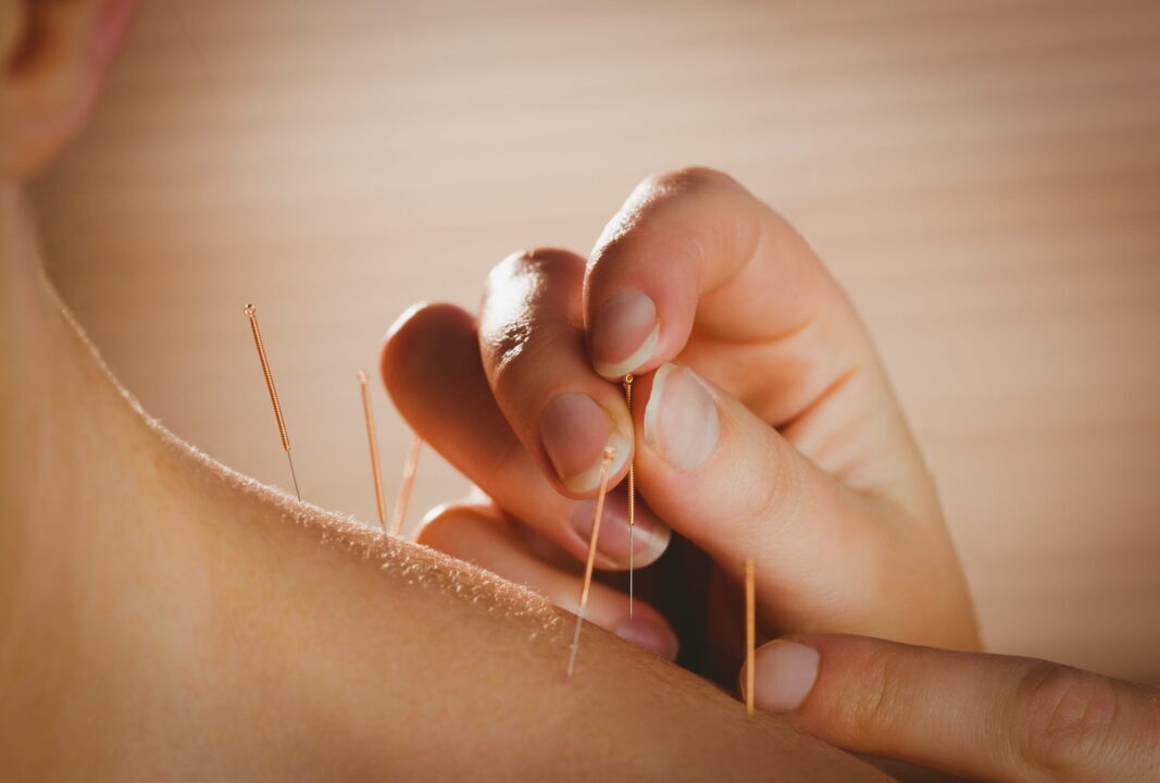 phương pháp y học cổ truyền